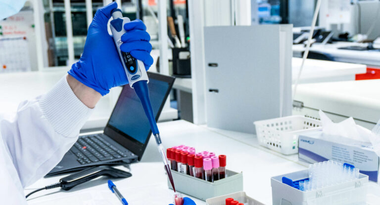 Samples are being examined in the Blood service laboratory.